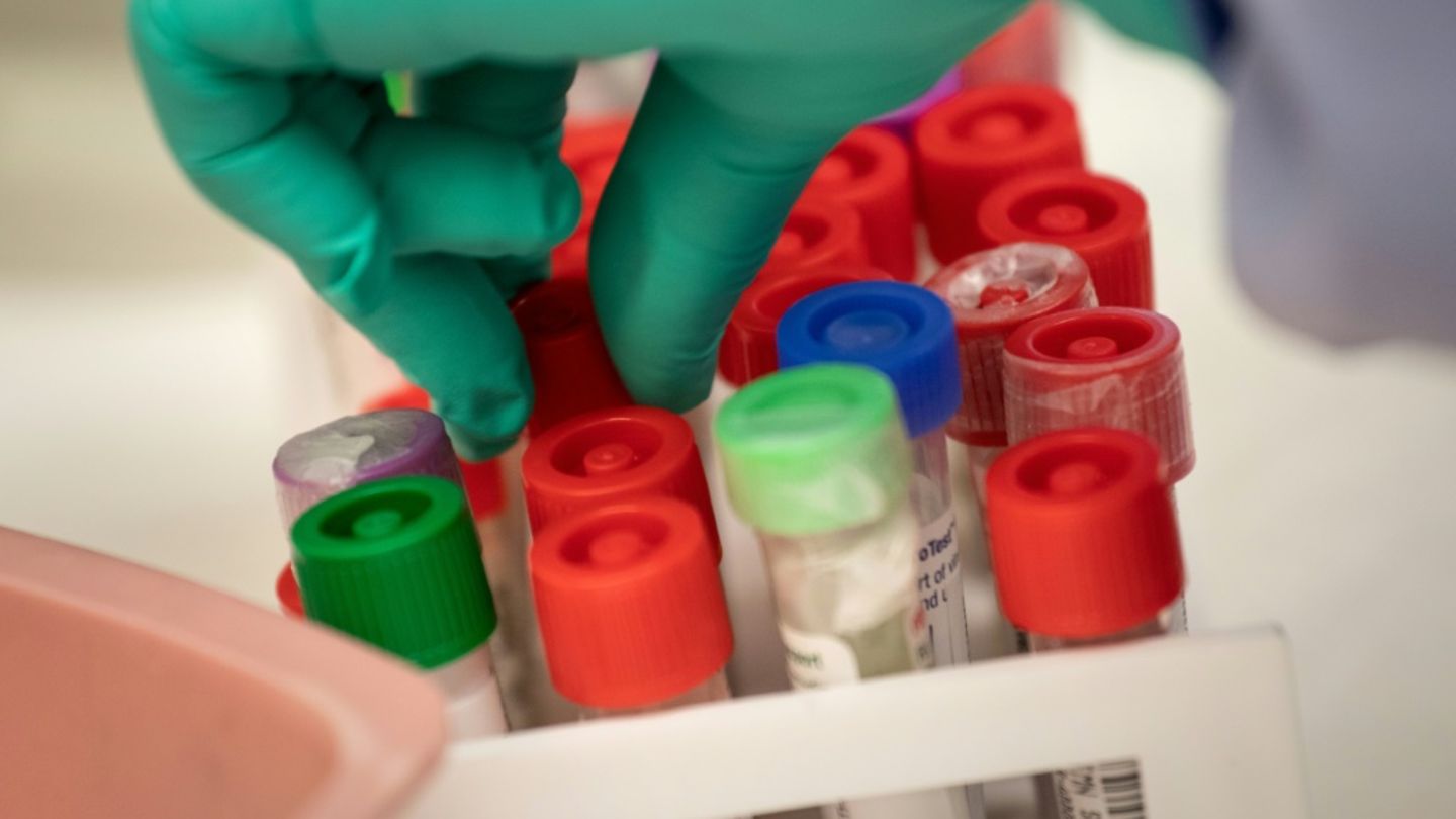 Infektionskrankheit Mpox breitet sich in Berlin aus – zehn Fälle in einer Woche