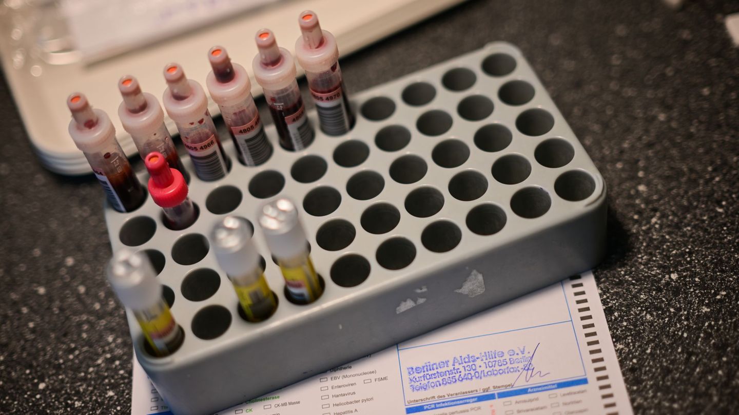 Geschlechtskrankheiten: Mehr Fälle von Syphilis in Bayern