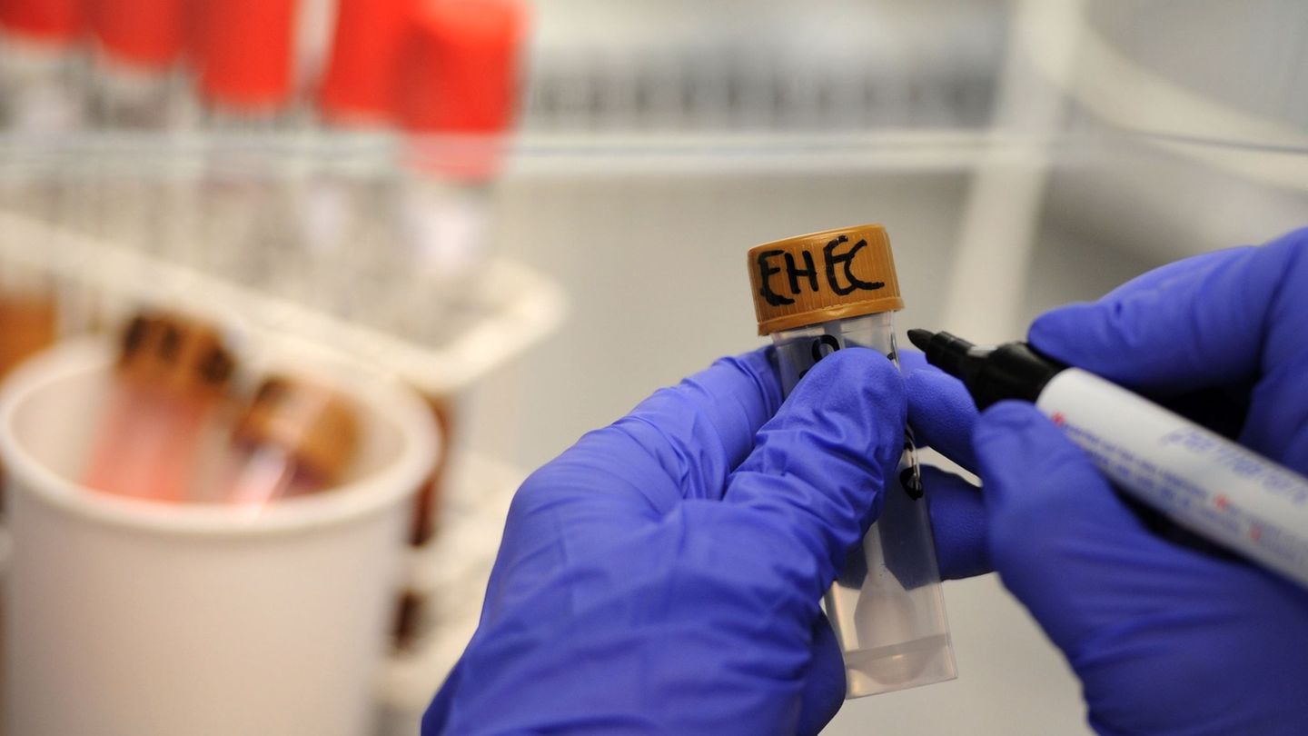 Ehec-Ausbruch in MV: Weitere Ehec-Fälle in MV – Behörden sprechen von Ausbruch
